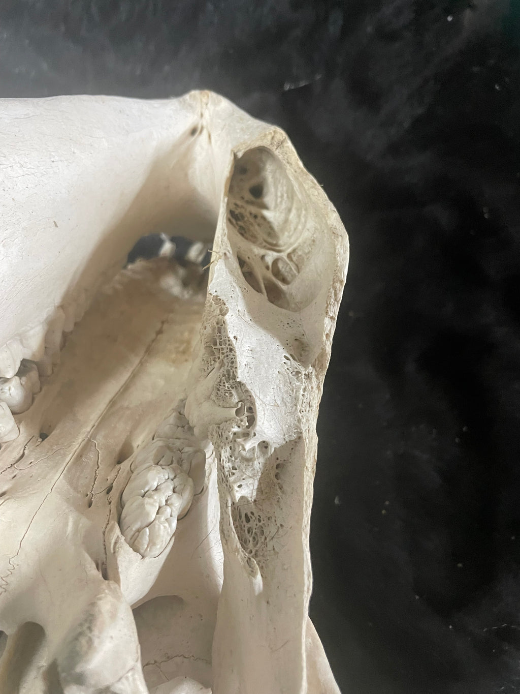 Bone Disease Kune Skull